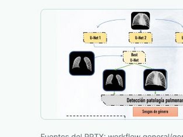 Máscaras y modelos U-Net para segmentación torácica