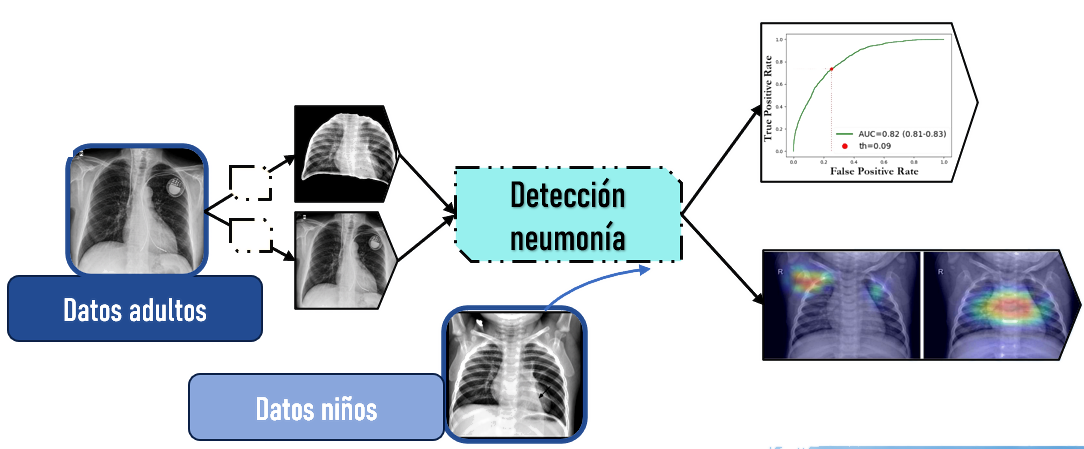 Workflow from adult chest X-ray data to pediatric validation of a pneumonia detection model