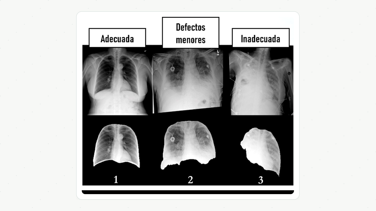 Thoracic segmentation quality reviewed through clinical criteria
